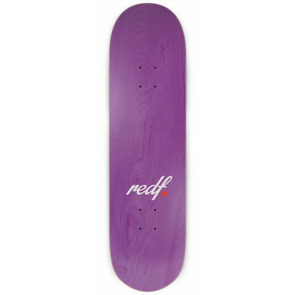 Joey Esteban - Injuries Paper